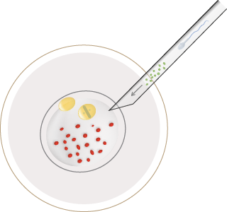 oocyte restoration