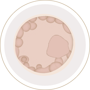 embryo transfer
